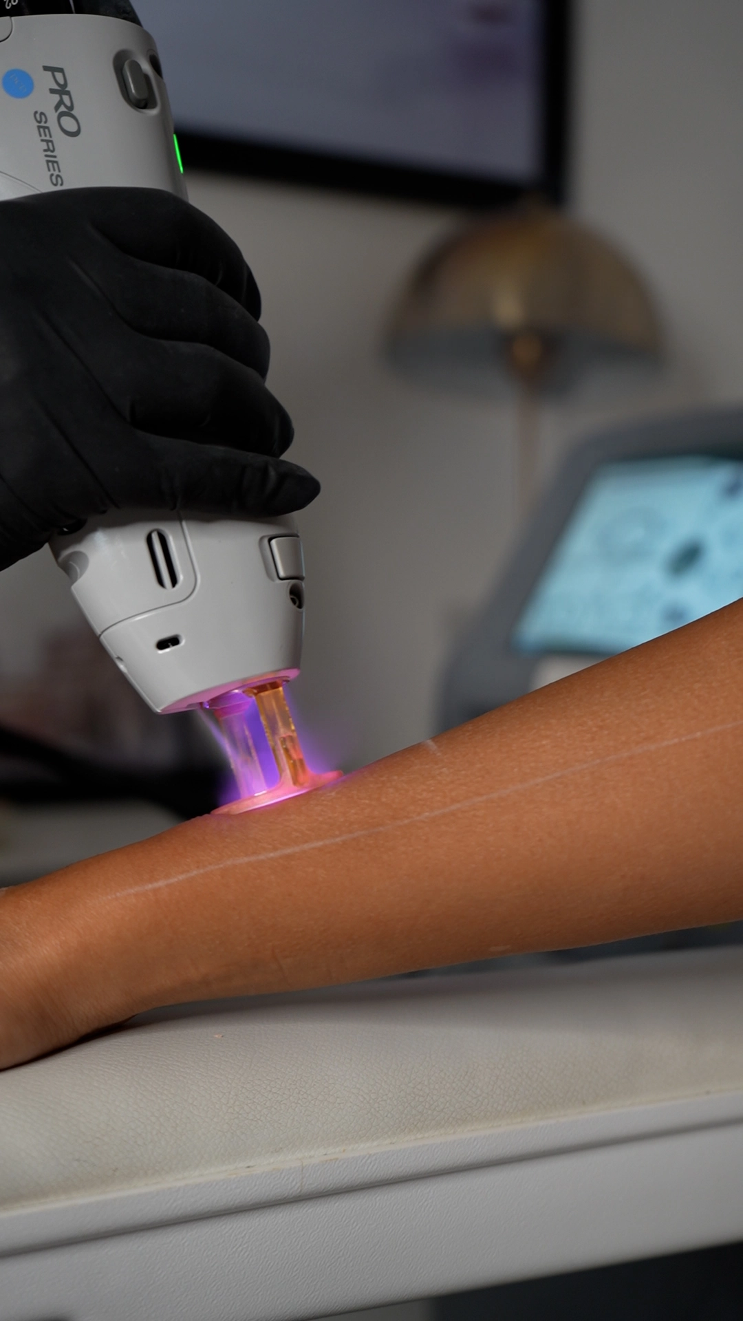Laser Hair Removal Dubai