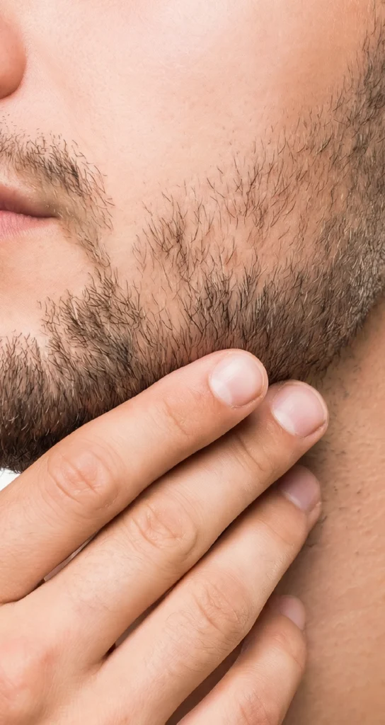 Male laser hair removal treatment at Estelaza Clinic, Dubai Silicon Oasis