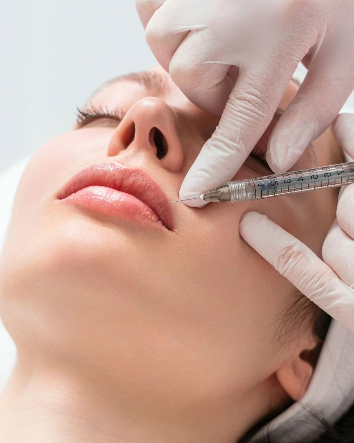 Lip Flip Botox treatment in Dubai 