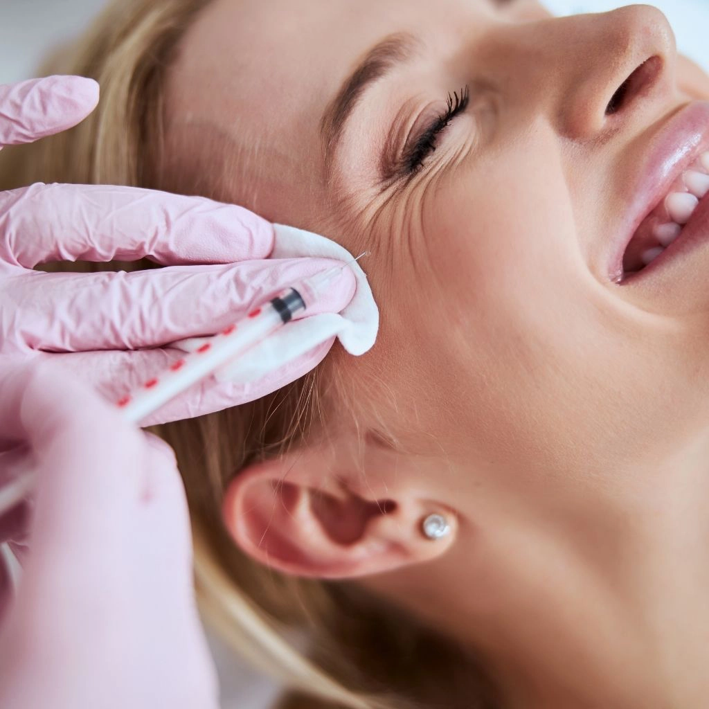 crow's feet botox in dubai