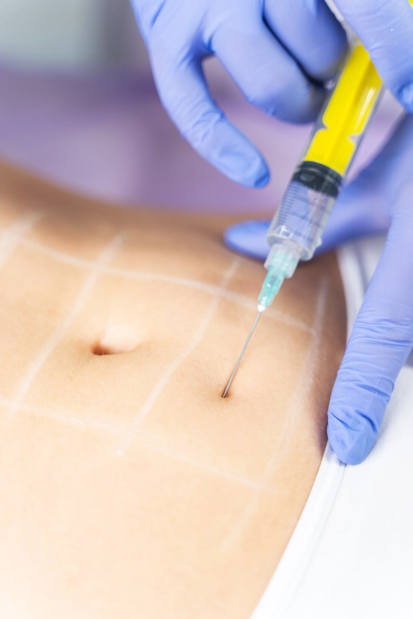 Fat Dissolving Injections in Dubai