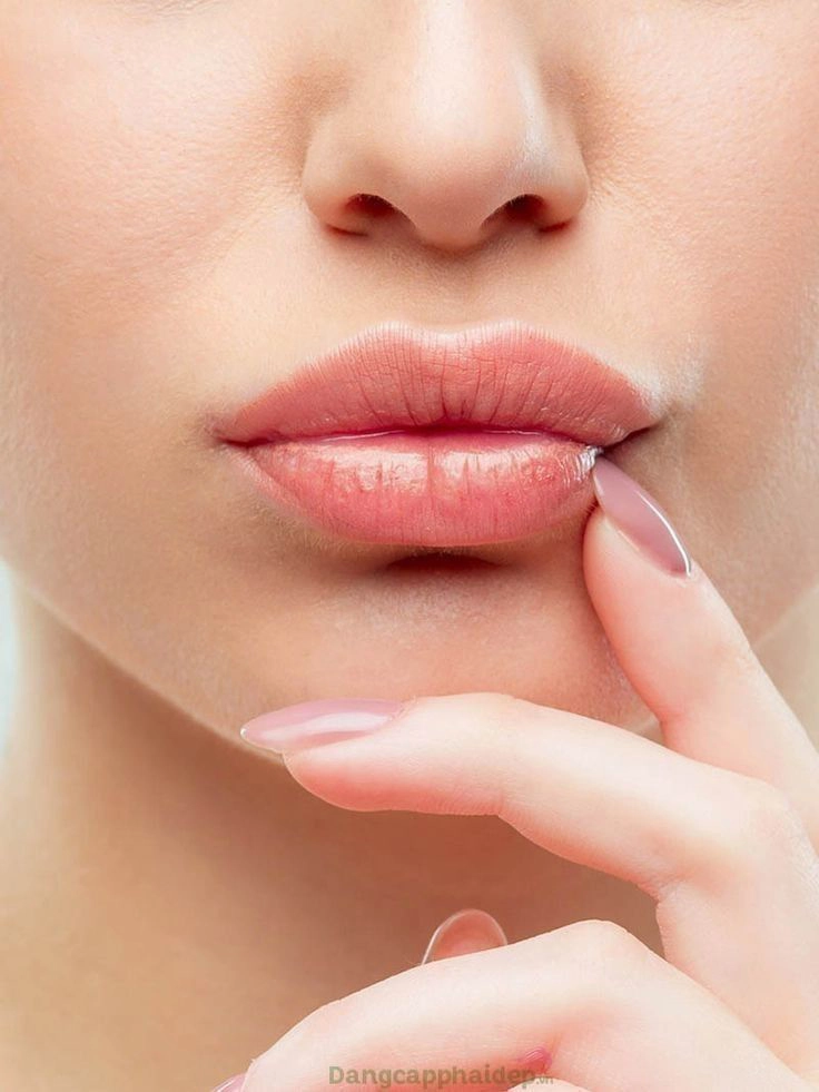 Lip Flip Botox treatment in Dubai 
