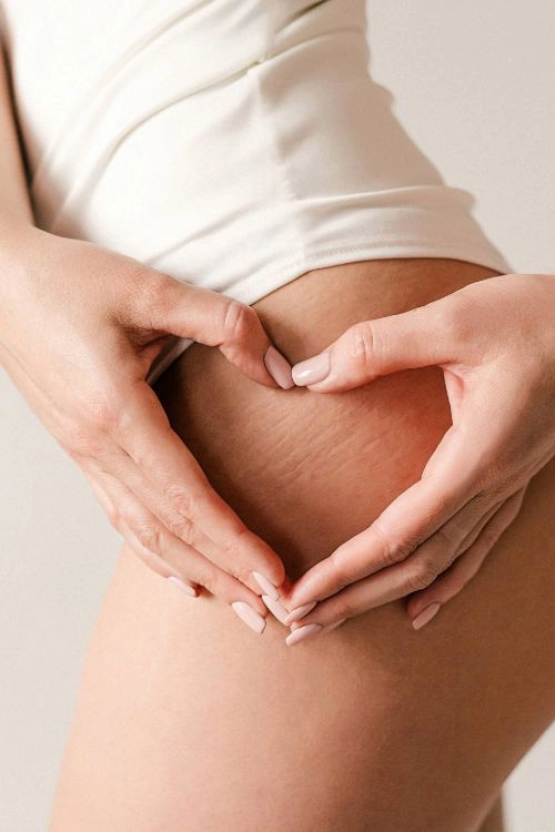 Cellulite Treatment