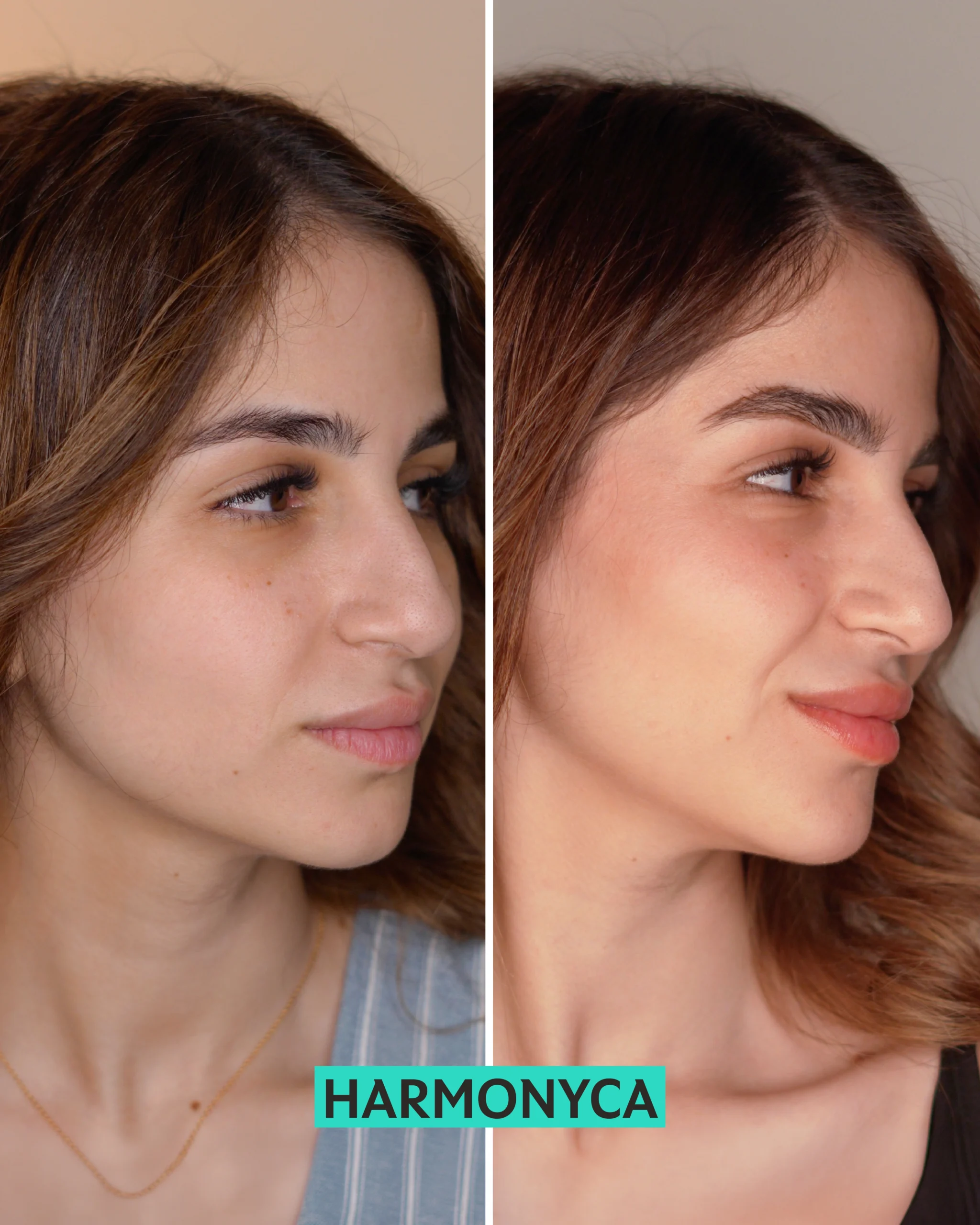 harmonyca