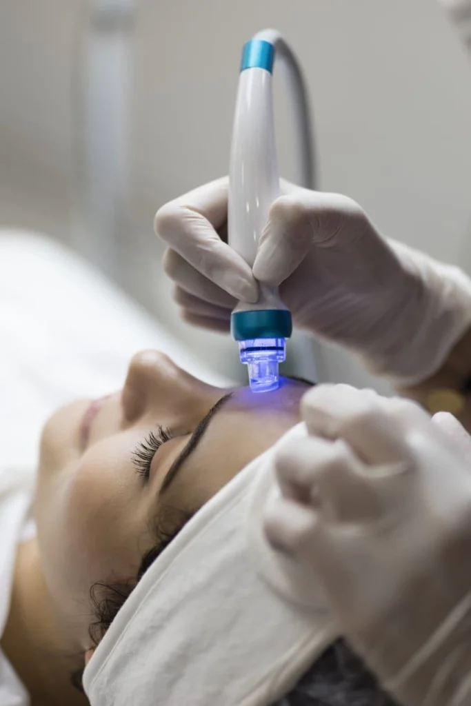 Microdermabrasion