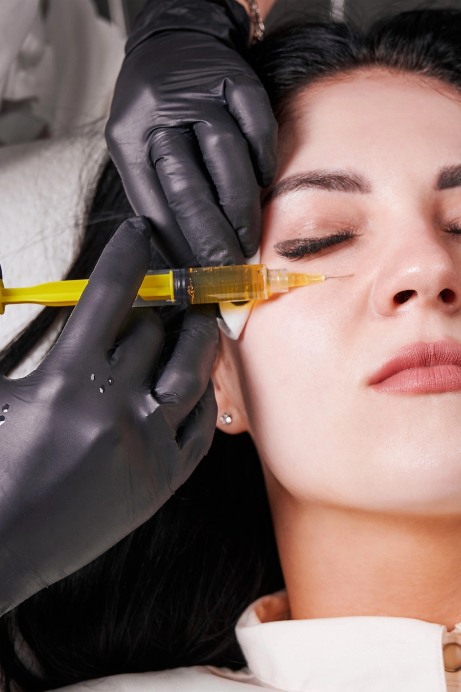 prp treatment