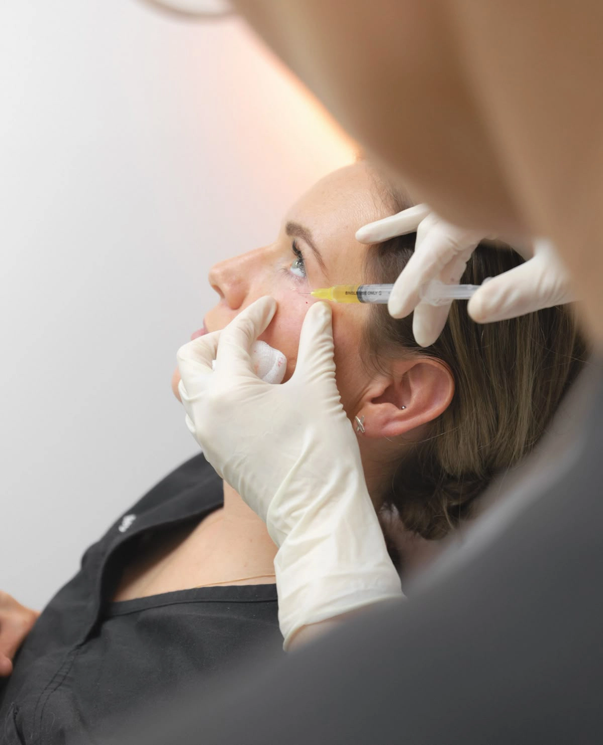 prp treatment