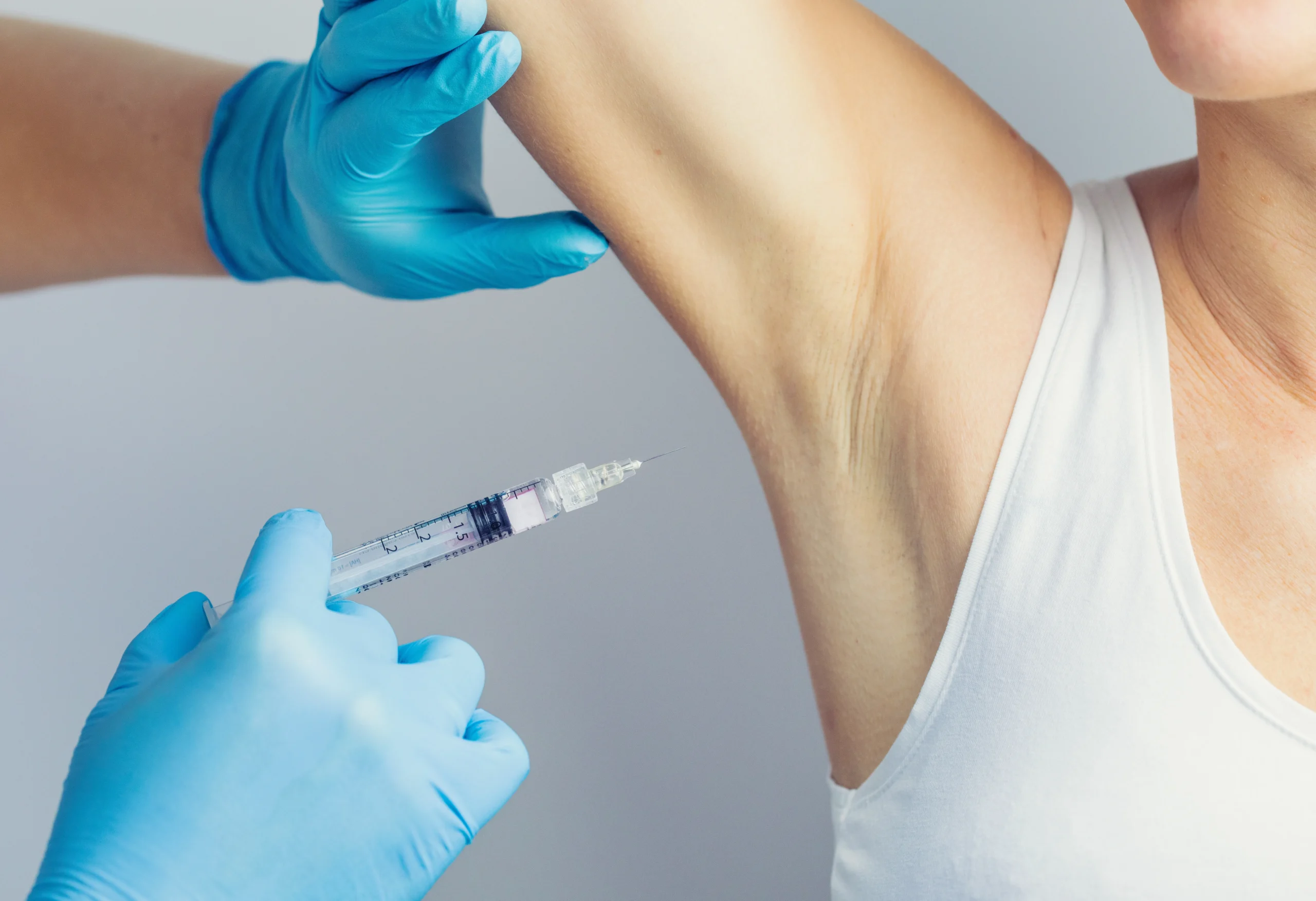 underarm botox